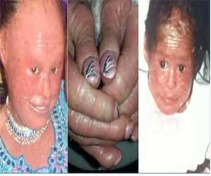 woman with fish scales skin