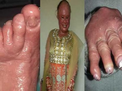 woman with fish scales skin