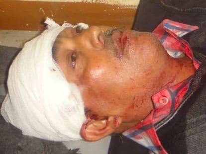 murder in udhamsingh nagar.