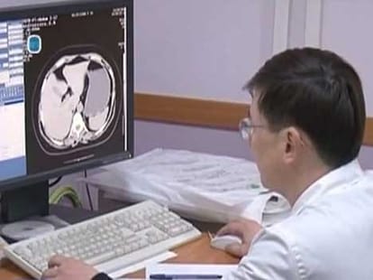 Man had scissors in his Stomach for 12 years in Kazakistan; Revealed in Xrays
