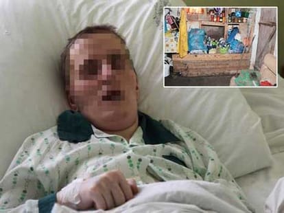 Mother chained and locked daughter in bathroom; found after an year rotting