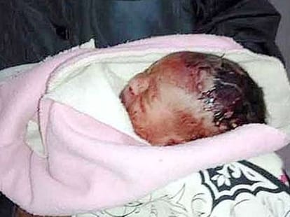 Mother abandoned Newborn baby girl in dumpster to be eaten by ants in Bhopal