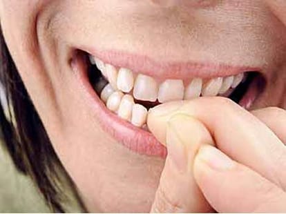 problems caused by nail biting