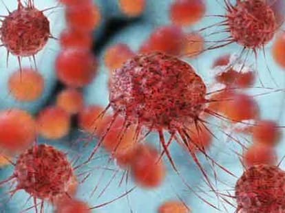 Cancer Day Special Story, Must Read