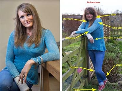 woman whose body twists upto 10 times a day