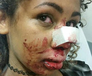 woman DJ was kicked in the face on nightclub dancefloor 