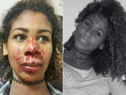 woman DJ was kicked in the face on nightclub dancefloor 