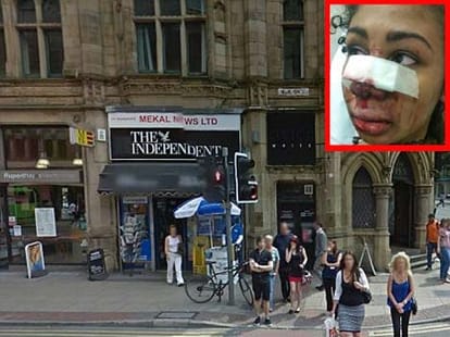 woman DJ was kicked in the face on nightclub dancefloor 