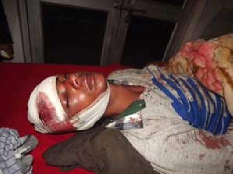 The young man was wounded in exposition