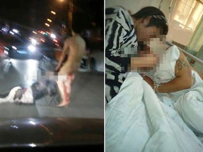 wife peels off husband's private part in hyderabad
