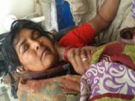 Women fight , two injured