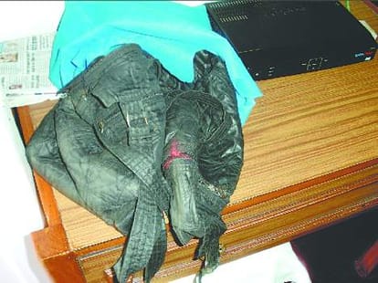 Shimla hotel robbed millions.