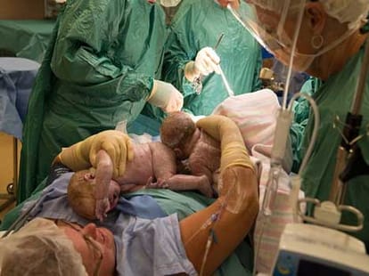 mother reaches her tummy and pulls out twins