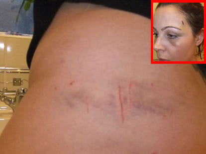 Woman runs naked through fields after boyfriend kidnaps her