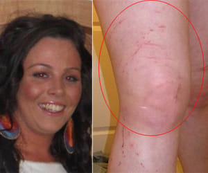 Woman runs naked through fields after boyfriend kidnaps her