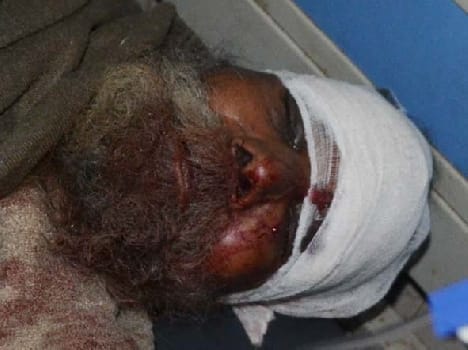 son died in road accident, father injured