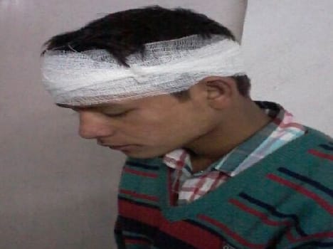 Youth beaten