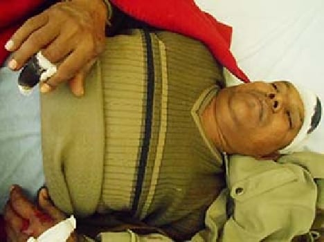 Three injured in the accident , including road inspector