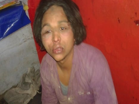 injured in firing