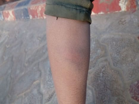 students beaten in school