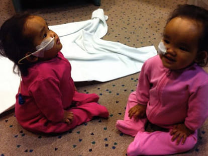 3-Year Old Twins Need A Liver Transplant 