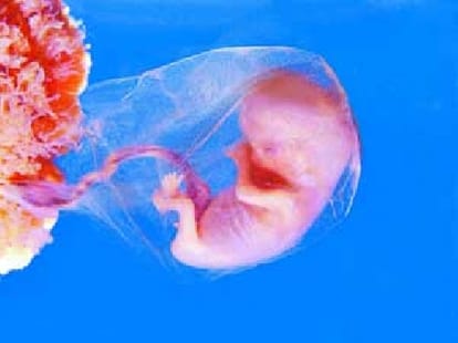 sensational truth related to female foeticide in india
