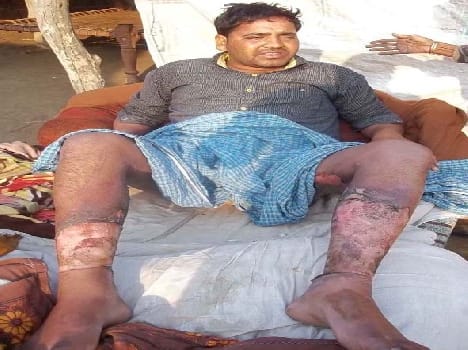 injured man