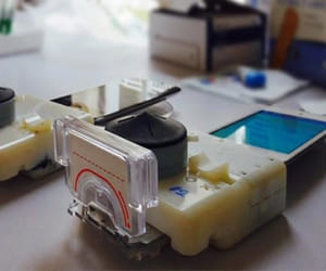 Smartphone blood test can screen for HIV