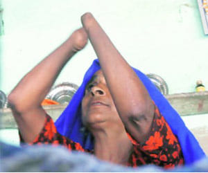 Justice denied for victim women who lost their hands
