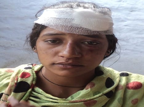 girl injured in train accident