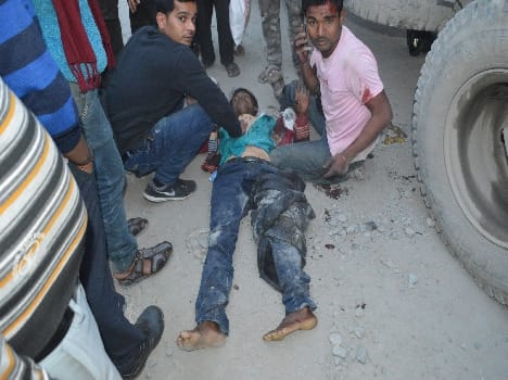 The bike rider dumper serious collision