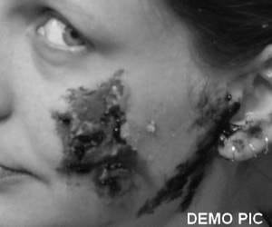molestation case at solan himachal.