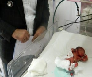 woman gave birth 600 gm child.