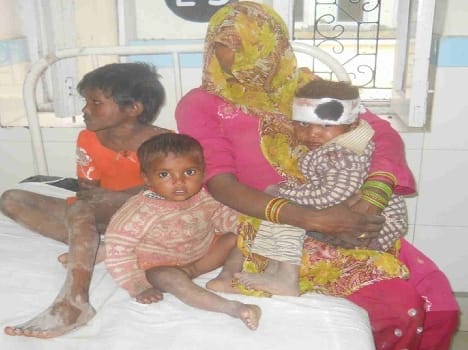 Dumper reflex, child deaths, 18 injured