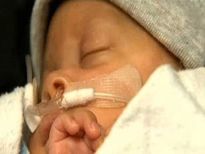baby comes out with amniotic cell intact