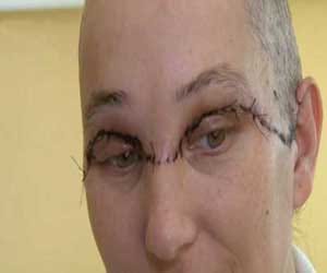 when head come out of skull