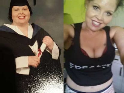 women left with saggy skin post weight loss surgery