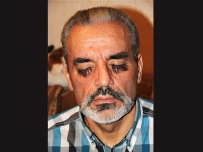man with longest leyebrows in the world