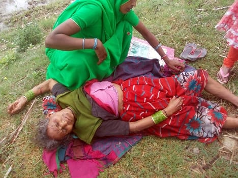 bike accident