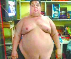 Iraqi man loses 30 kg weight after surgery in delhi.