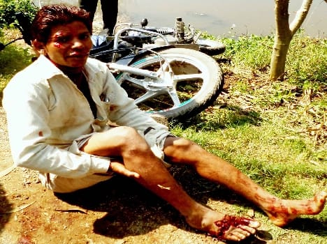 Road accidents student Seven injured