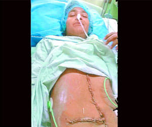AIIMS doctors made a news record in the field of surgery