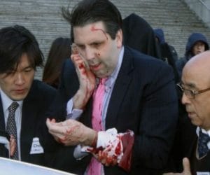 attack on american envoy in south korea.