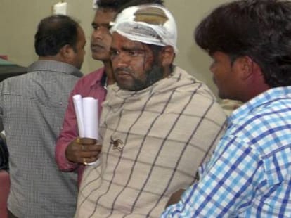 936 people reached to hospital on holi