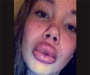 bad lip job that ruined everything