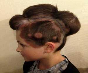 when ballons were planted inside head