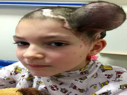 when ballons were planted inside head