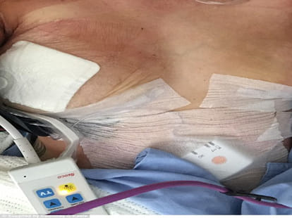 breast cancer in men also.