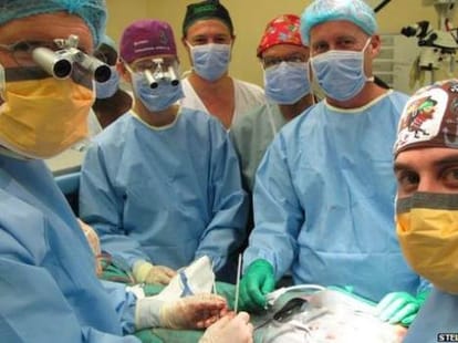 south africans performs first panis transplant.