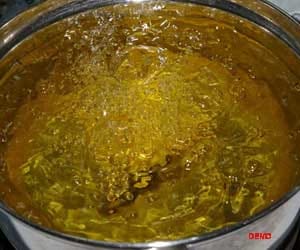6 years old girl falling in a frying oil pan scorched 